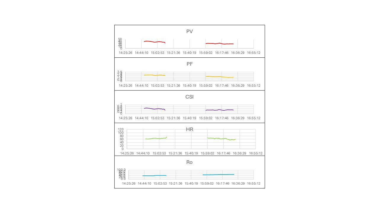Figure 1. Representative hemodynamic metrics from the Advanced Pulse Flowmeter showing Pulse Volume (PV), Pulse Flow (PF), Compensated Shock Index (CSI), Heart Rate (HR), and Baseline Impedance (Ro) over time. Despite normal vital signs, this patient showed a 22% decrease in PV, 9% decrease in PF, 10% increase in HR, and 35% decrease in CSI prior to endoscopy — predicting active bleeding that was confirmed endoscopically.